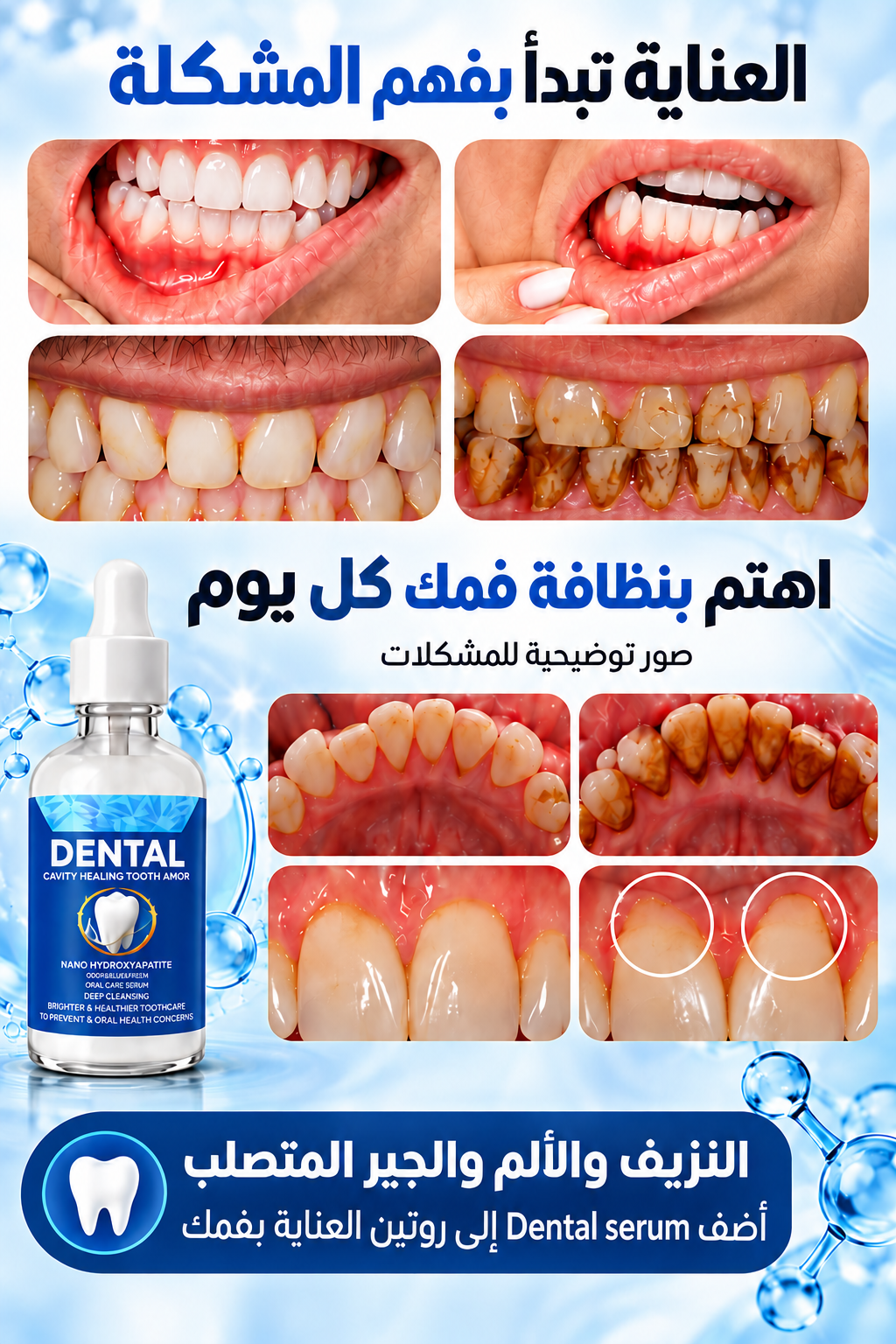 Dental serum